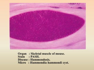 Computer Mouse Cyst pathology of Parasitic diseases | PDF