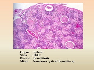 pathology of Parasitic diseases | PDF