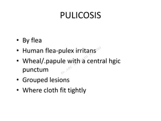 PULICOSIS
• By flea
• Human flea-pulex irritans
• Wheal/.papule with a central hgic
punctum
• Grouped lesions
• Where cloth fit tightly
 