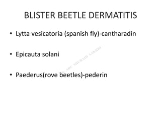 BLISTER BEETLE DERMATITIS
• Lytta vesicatoria (spanish fly)-cantharadin
• Epicauta solani
• Paederus(rove beetles)-pederin
 
