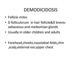 DEMODICIDOSIS
• Follicle mites
• D folliculorum in hair follicle&D brevis-
sebaceous and meibomian glands
• Usually in older children and adults
• Forehead,cheeks,nasolabial folds,chin
,scalp,external ear,upper chest
 