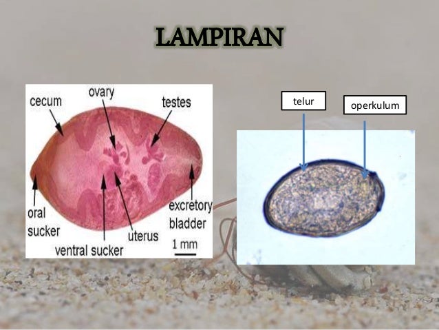 101+ Gambar Telur Cacing Paragonimus Westermani HD 101+ Gambar Telur Cacing Paragonimus Westermani HD