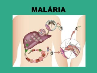 MALÁRIA
 