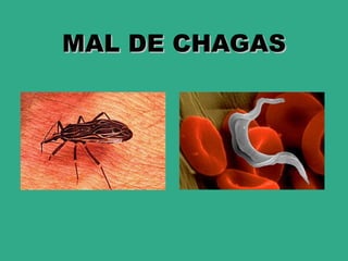 MAL DE CHAGAS
 