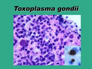 Toxoplasma gondii
 