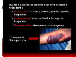 Quanto à classificação segundo a zona onde atacam o
hospedeiro :
   Ectoparasitas : atacam a parte exterior do corpo do
    hospedeiro.
   Endoparasitas : vivem no interior do corpo do
    hospedeiro.
   Hemo parasitas : vivem na corrente sanguínea.



 Exemplo de
Hemo parasita.
 