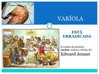 VARÍOLA 
ESTÁ 
ERRADICADA 
O criador da primeira 
vacina, contra a varíola, foi 
Edward Jenner 
 