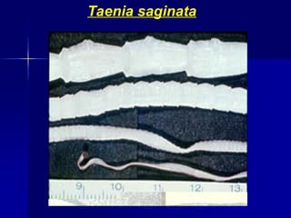 Taenia saginata
 