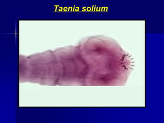 Taenia solium
 