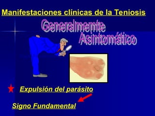 Manifestaciones clínicas de la Teniosis
Expulsión del parásito
Signo Fundamental
Signo Fundamental
 