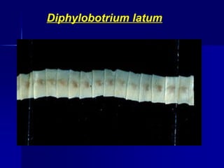 Diphylobotrium latum
 