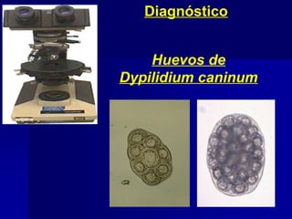 Diagnóstico
Huevos de
Dypilidium caninum
 
