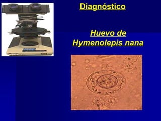 Diagnóstico
Huevo de
Hymenolepis nana
 