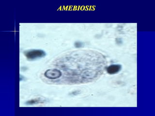 AMEBIOSIS
 
