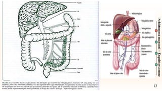 13
Schistosoma
mansoni
–
Esquistossomose
 