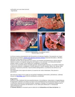 confundirlo con una masa tumoral.
- Apendicitis.
Lesiones en intestino grueso (1 - 3) y 4) Absceso hepático.
CDC/Dr M. Melvin, Dr. West
La forma invasiva extraintestinal más frecuente es el absceso hepático. Se presenta con mayor
frecuencia en hombres. Amebic liver abscess and liver cirrhosis (Guevara-González L, Méndez-
Sánchez N. Mini caso clínico e imagen).
Alrededor del 60% de los abscesos son únicos y se localizan principalmente en lóbulo derecho,
debido en parte a la irrigación sanguínea del órgano y a su volumen. Los trofozoítos también
pueden migrar a a este y otros tejidos por contigüidad o continuidad.
Involucra un importante ataque al estado general, hepatomegalia dolorosa, con posible irradiación
a hipocondrio derecho, a epigastrio, hombro derecho e incluso espalda, fiebre, tos, disnea, dolor
durante la inspiración profunda e hipomovilidad diafragmática. La presencia de ictericia no es
frecuente.
Se contemplan como signos de alarma, la ausencia de ruidos intestinales, frote pleural o
pericárdico.
Son raros los casos en los cuales se encuentran metástasis pulmonares, pericárdicas, cutáneas
(buscar en DermAtlas. org el término amebiasis) y cerebrales.
Diagnóstico.
Se lleva a cabo mediante técnicas parasitoscópicas, inmunológicas, moleculares e imagenológicas.
El diagnóstico definitivo se realiza con base en las manifestaciones clínicas/observación de quistes
o trofozoítos obtenidos de muestras fecales, raspados o biopsias. Es importante enfatizar que la
mayor parte de los estudios de laboratorio no son útiles para diferenciar E. histolytica/E.
dispar/E.Moshkovskii.
El examen directo es necesario para la detección de trofozoítos en la fase de diarrea. La
 