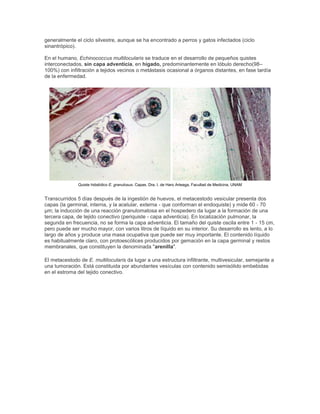 generalmente el ciclo silvestre, aunque se ha encontrado a perros y gatos infectados (ciclo
sinantrópico).
En el humano, Echinococcus multilocularis se traduce en el desarrollo de pequeños quistes
interconectados, sin capa adventicia, en hígado, predominantemente en lóbulo derecho(98–
100%) con infiltración a tejidos vecinos o metástasis ocasional a órganos distantes, en fase tardía
de la enfermedad.
Quiste hidatídico E. granulosus. Capas. Dra. I. de Haro Arteaga, Facultad de Medicina, UNAM
Transcurridos 5 días después de la ingestión de huevos, el metacestodo vesicular presenta dos
capas (la germinal, interna, y la acelular, externa - que conforman el endoquiste) y mide 60 - 70
µm; la inducción de una reacción granulomatosa en el hospedero da lugar a la formación de una
tercera capa, de tejido conectivo (periquiste - capa adventicia). En localización pulmonar, la
segunda en frecuencia, no se forma la capa adventicia. El tamaño del quiste oscila entre 1 - 15 cm,
pero puede ser mucho mayor, con varios litros de líquido en su interior. Su desarrollo es lento, a lo
largo de años y produce una masa ocupativa que puede ser muy importante. El contenido líquido
es habitualmente claro, con protoescólices producidos por gemación en la capa germinal y restos
membranales, que constituyen la denominada "arenilla".
El metacestodo de E. multilocularis da lugar a una estructura infiltrante, multivesicular, semejante a
una tumoración. Está constituida por abundantes vesículas con contenido semisólido embebidas
en el estroma del tejido conectivo.
 