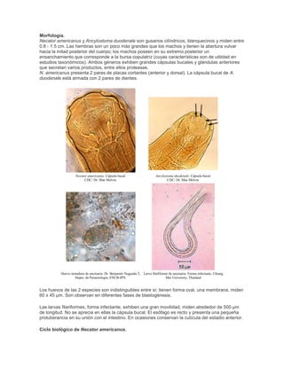 Morfología.
Necator americanus y Ancylostoma duodenale son gusanos cilíndricos, blanquecinos y miden entre
0.8 - 1.5 cm. Las hembras son un poco más grandes que los machos y tienen la abertura vulvar
hacia la mitad posterior del cuerpo; los machos poseen en su extremo posterior un
ensanchamiento que corresponde a la bursa copulatriz (cuyas características son de utilidad en
estudios taxonómicos). Ambos géneros exhiben grandes cápsulas bucales y glándulas anteriores
que secretan varios productos, entre ellos proteasas.
N. americanus presenta 2 pares de placas cortantes (anterior y dorsal). La cápsula bucal de A.
duodenale está armada con 2 pares de dientes.
Necator americanus. Cápsula bucal.
CDC/ Dr. Mae Melvin.
Ancylostoma duodenale. Cápsula bucal.
CDC/ Dr. Mae Melvin.
Huevo inmaduro de uncinaria. Dr. Benjamín Nogueda T,
Depto. de Parasitología, ENCB-IPN.
Larva filafiforme de uncinaria. Forma infectante. Chiang
Mai University, Thailand
Los huevos de las 2 especies son indistinguibles entre sí; tienen forma oval, una membrana, miden
60 x 45 µm. Son observan en diferentes fases de blastogénesis.
Las larvas filariformes, forma infectante, exhiben una gran movilidad, miden alrededor de 500 µm
de longitud. No se aprecia en ellas la cápsula bucal. El esófago es recto y presenta una pequeña
protuberancia en su unión con el intestino. En ocasiones conservan la cutícula del estadio anterior.
Ciclo biológico de Necator americanus.
 