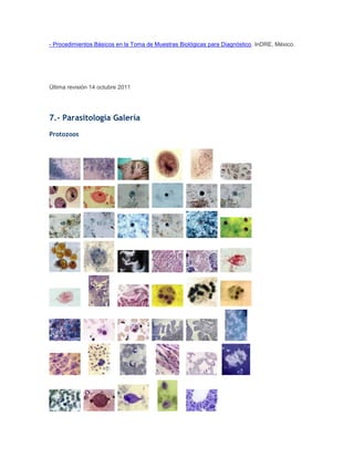 - Procedimientos Básicos en la Toma de Muestras Biológicas para Diagnóstico. InDRE, México.
Última revisión 14 octubre 2011
7.- Parasitología Galería
Protozoos
 