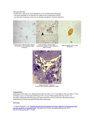 alta especificidad.
- ELISA para captura de coproantígenos e inmunoelectrotransferencia.
- Técnicas basadas en la reacción en cadena de la polimerasa (PCR).
- Las técnicas invasivas, como son el sondeo duodenal y biopsia intestinal.
Examen directo. Solución salina. Quistes
de Giardia. J.C.Fox, Oklahoma State
University
Examen directo. Solución salina.
Trofozoitos de Giardia. J.C.Fox, Oklahoma
State University
Quiste de Giardia. Tinción: lugol.
DPDx/CDC.
Biopsia duodenal. Trofozoítos.
R. Acuña Soto, Facultad de Medicina, UNAM
Tratamiento.
Albendazol 400 mg/d x 5 d, Metronidazol 250 mg c/8h x 5 d, Furazolidona,100 mg c/6h x 7-10 d,
Tinidazol 2 g x 2 d, Secnidazol 600 mg c/12h x 2-3 d, Nitaxozanida 500 mg c/12h x 3 d.
Se están realizando estudios para dar apoyo científico al uso tradicional de plantas para el
tratamiento de trastornos gastrointestinales infecciosos.
Vínculos.
- C Maia-Brigagão, et al. Giardia disrupts the arrangement of tight, adherens and desmosomal
junction proteins of intestinal cells. Parasitol Int In Press, Accepted Manuscript, 2011.
doi:10.1016/j.parint.2011.11.002
 