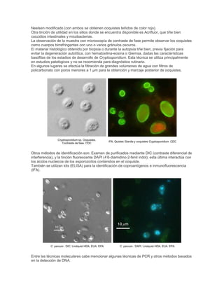 Neelsen modificado (con ambos se obtienen ooquistes teñidos de color rojo).
Otra tinción de utilidad en los sitios donde se encuentra disponible es Acrifluor, que tiñe bien
coccidios intestinales y micobacterias.
La observación de la muestra con microscopía de contraste de fase permite observar los ooquistes
como cuerpos birrefringentes con uno o varios gránulos oscuros.
El material histológico obtenido por biopsia o durante la autopsia tiñe bien, previa fijación para
evitar la degeneración autolítica, con hematoxilina-eosina o Giemsa, dadas las características
basófilas de los estadios de desarrollo de Cryptosporidium. Esta técnica se utiliza principalmente
en estudios patológicos y no se recomienda para diagnóstico rutinario.
En algunos lugares se efectúa la filtración de grandes volúmenes de agua con filtros de
policarbonato con poros menores a 1 µm para la obtención y marcaje posterior de ooquistes.
Cryptosporidium sp. Ooquistes.
Contraste de fase. CDC
IFA. Quistes Giardia y ooquistes Cryptosporidium. CDC
Otros métodos de identificación son: Examen de purificados mediante DIC (contraste diferencial de
interferencia), y la tinción fluorescente DAPI (4‘6-diamidino-2-fenil indol); esta última interactúa con
los ácidos nucleicos de los esporozoítos contenidos en el ooquiste.
También se utilizan kits (ELISA) para la identificación de coproantígenos e inmunofluorescencia
(IFA).
C. parvum . DIC. Lindquist HDA, EUA. EPA C. parvum . DAPI. Lindquist HDA, EUA. EPA
Entre las técnicas moleculares cabe mencionar algunas técnicas de PCR y otros métodos basados
en la detección de DNA.
 