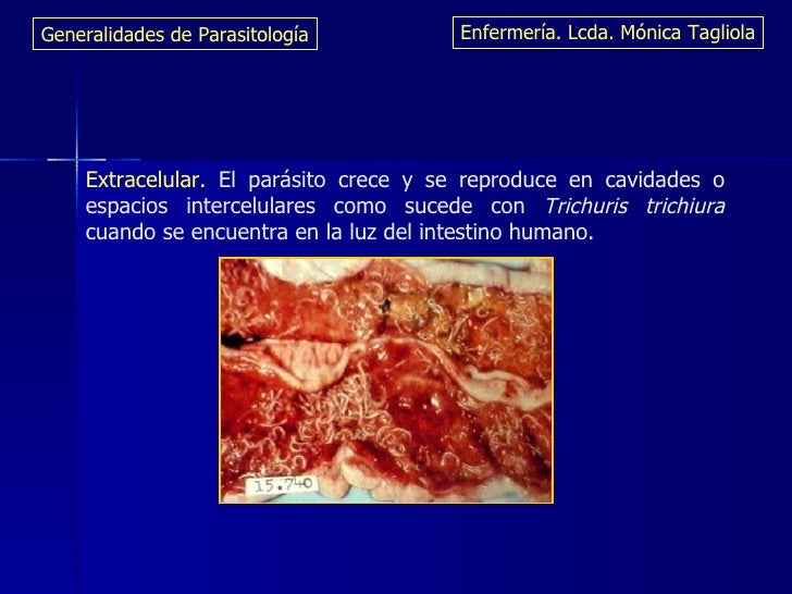Las pastillas buenas de las lombrices para la persona a todos los tipos