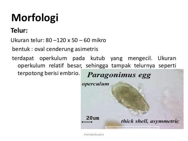 101+ Gambar Telur Cacing Paragonimus Westermani HD 101+ Gambar Telur Cacing Paragonimus Westermani HD