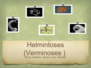 Helmintoses
(Verminoses )
(Do gr. Helmins, 'verme' e ose, 'doença')
 