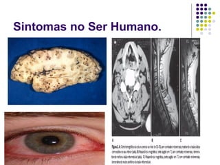 Sintomas no Ser Humano.
 