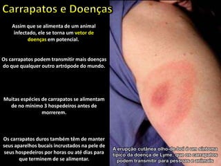 As doenças que os carrapatos transmitem
variam de um lugar para o outro. Isso
acontece porque animais distintos e as
doenças específicas de cada espécie se
desenvolvem em diferentes partes do mundo.
Mas isso não impede que as doenças
transmitidas por carrapatos se espalhem para
fora de uma área geográfica em particular.
Um bom exemplo é a febre maculosa de
Rocky Mountain , a primeira doença que
possui um carrapato como vetor a ser
positivamente identificada.
Assim que se alimenta de um animal
infectado, ele se torna um vetor de
doenças em potencial.
Os carrapatos podem transmitir mais doenças
do que qualquer outro artrópode do mundo.
Muitas espécies de carrapatos se alimentam
de no mínimo 3 hospedeiros antes de
morrerem.
Os carrapatos duros também têm de manter
seus aparelhos bucais incrustados na pele de
seus hospedeiros por horas ou até dias para
que terminem de se alimentar.
A erupção cutânea olho-de-boi é um sintoma
típico da doença de Lyme, que os carrapatos
podem transmitir para pessoas e animais
 