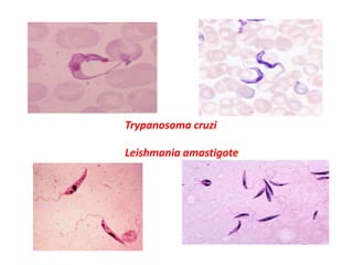 Trypanosoma cruzi 
Leishmania amastigote 
 