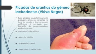Picadas de aranhas do gênero
lactrodectus (Viúva Negra)
 Suas picadas caracteristicamente
produzem alterações sensoriais no
local da picada, o sistema nervoso
autônomo é envolvido com
liberação de neuromediadores
podendo ocorrer:
 contratura facial e trismo;
 retenção urinária
 hipertensão arterial
 taquicardia ou bradicardia.
 