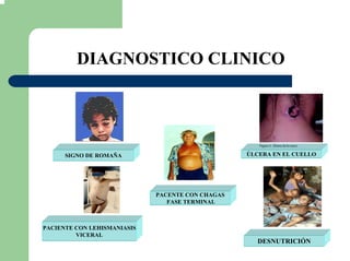 DIAGNOSTICO CLINICO
ÚLCERA EN EL CUELLOSIGNO DE ROMAÑA
PACENTE CON CHAGAS
FASE TERMINAL
PACIENTE CON LEHISMANIASIS
VICERAL
DESNUTRICIÓN
 
