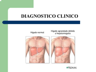 DIAGNOSTICO CLINICO
 