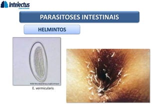 HELMINTOS
PARASITOSES INTESTINAIS
E. vermicularis
 