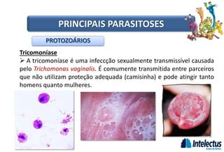 Tricomoníase
 A tricomoníase é uma infeccção sexualmente transmissível causada
pelo Trichomonas vaginalis. É comumente transmitida entre parceiros
que não utilizam proteção adequada (camisinha) e pode atingir tanto
homens quanto mulheres.
PROTOZOÁRIOS
PRINCIPAIS PARASITOSES
 