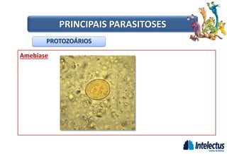 Amebíase
PROTOZOÁRIOS
PRINCIPAIS PARASITOSES
 