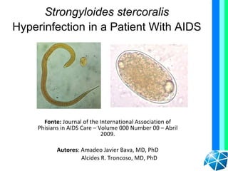 Strongyloides stercoralis
Hyperinfection in a Patient With AIDS




      Fonte: Journal of the International Association of
    Phisians in AIDS Care – Volume 000 Number 00 – Abril
                             2009.

           Autores: Amadeo Javier Bava, MD, PhD
                    Alcides R. Troncoso, MD, PhD
 