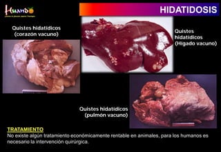Quistes hidatídicos
(corazón vacuno)
Quistes hidatídicos
(pulmón vacuno)
TRATAMIENTO
No existe algún tratamiento económicamente rentable en animales, para los humanos es
necesario la intervención quirúrgica.
Quistes
hidatídicos
(Hígado vacuno)
HIDATIDOSIS
 