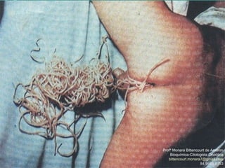 Profª Monara Bittencourt de Amorim
Bioquímica-Citologista Oncótica
bittencourt.monara7@gmail.com
84 9985 8153
 