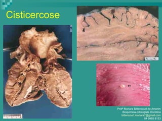 Cisticercose
Profª Monara Bittencourt de Amorim
Bioquímica-Citologista Oncótica
bittencourt.monara7@gmail.com
84 9985 8153
 