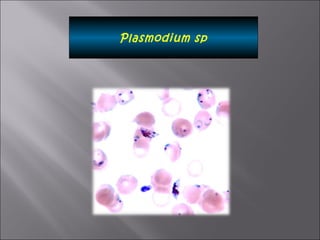 Plasmodium sp 
 
