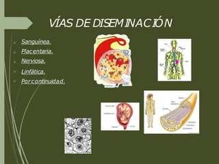 VÍAS DE DISEMINACIÓN





Sanguínea.
Placentaria.
Nerviosa.
Linfática.
Por continuidad.
 