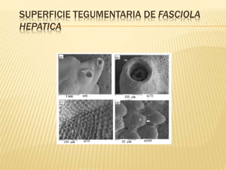 SUPERFICIE TEGUMENTARIA DE FASCIOLA 
HEPATICA 
 