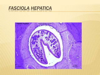 FASCIOLA HEPATICA 
 