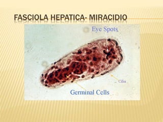 FASCIOLA HEPATICA- MIRACIDIO 
 