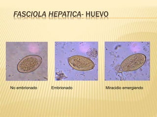 FASCIOLA HEPATICA- HUEVO 
No embrionado Embrionado Miracidio emergiendo 
 
