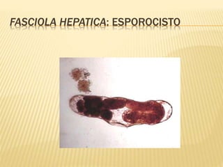 FASCIOLA HEPATICA: ESPOROCISTO 
 