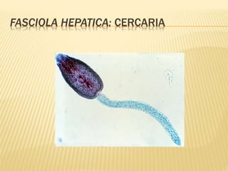 FASCIOLA HEPATICA: CERCARIA 
 