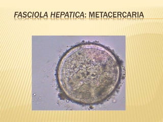 FASCIOLA HEPATICA: METACERCARIA 
 